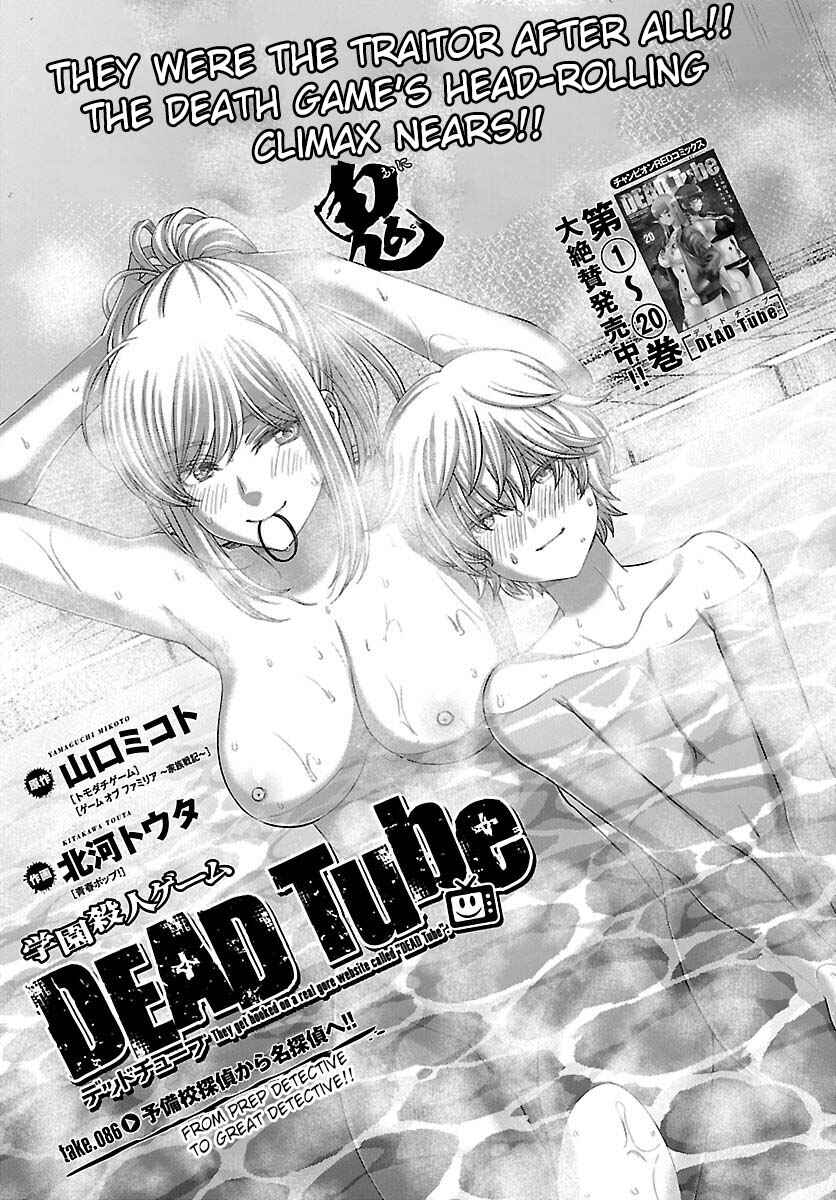 Page 4 Chapter 86 DEAD Tube